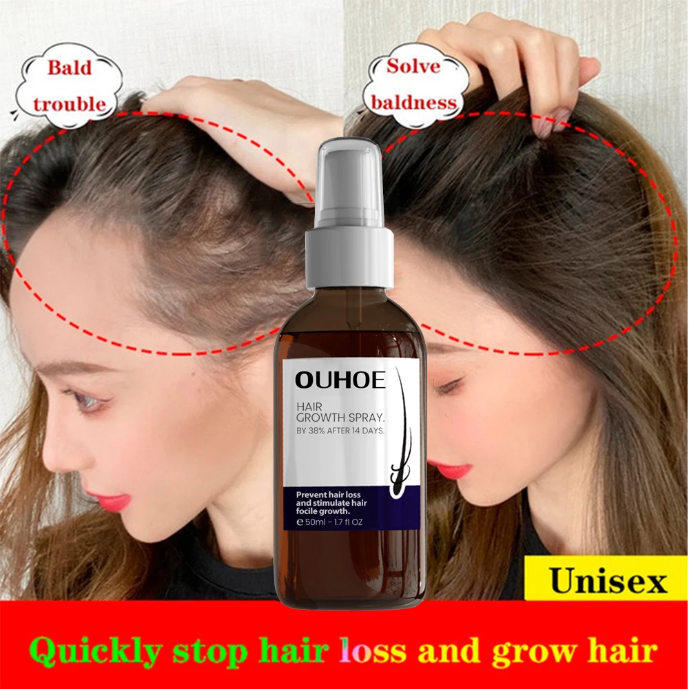 

Anti-Baldness Ginger Hair Growth Serum Spray Anti Hair Loss Hair Regrowth Liquid Scalp Treatment Essence Oil For Women & Men