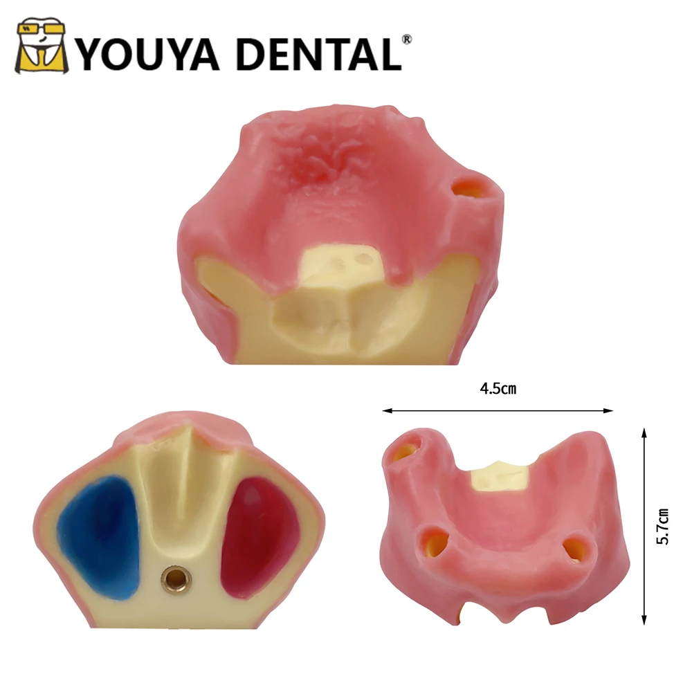 

Dental Implant Teaching Model Edentulous Maxillary Sinus with Soft Gums Teeth Implant Practice Training Studying Model