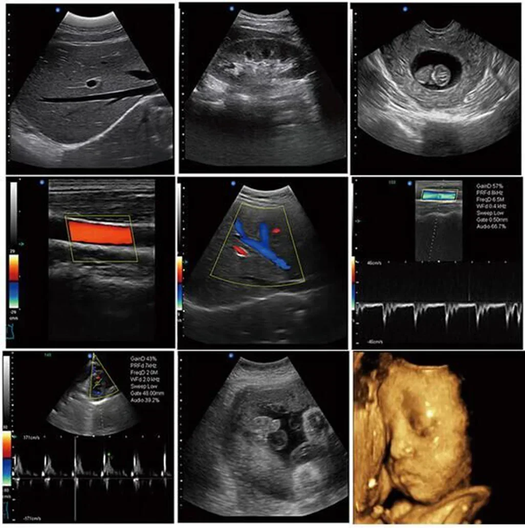 High end echocardiography portable for medical image system ultrasound gyn 2d 3d 4d Sonography