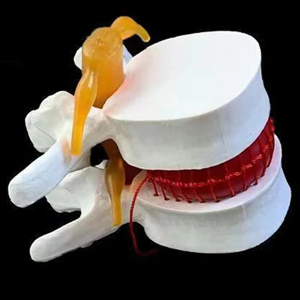 

Человеческий анатомический Поясничный диск, медицинский анатомический помощь для обучения, инструкция по анатомии, учебные инструменты для школьного обучения