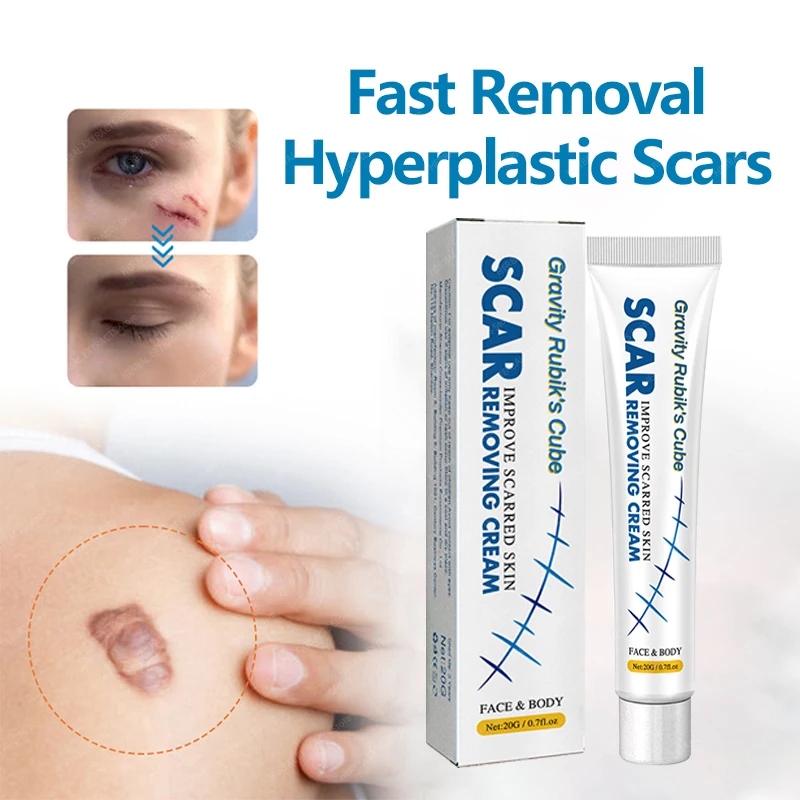 

Creme de Remoção de Cicatrizes, Cesariana, Estrias, Cicatrizes cirúrgicas, Queimar Escalda, Cicatrizes Graves