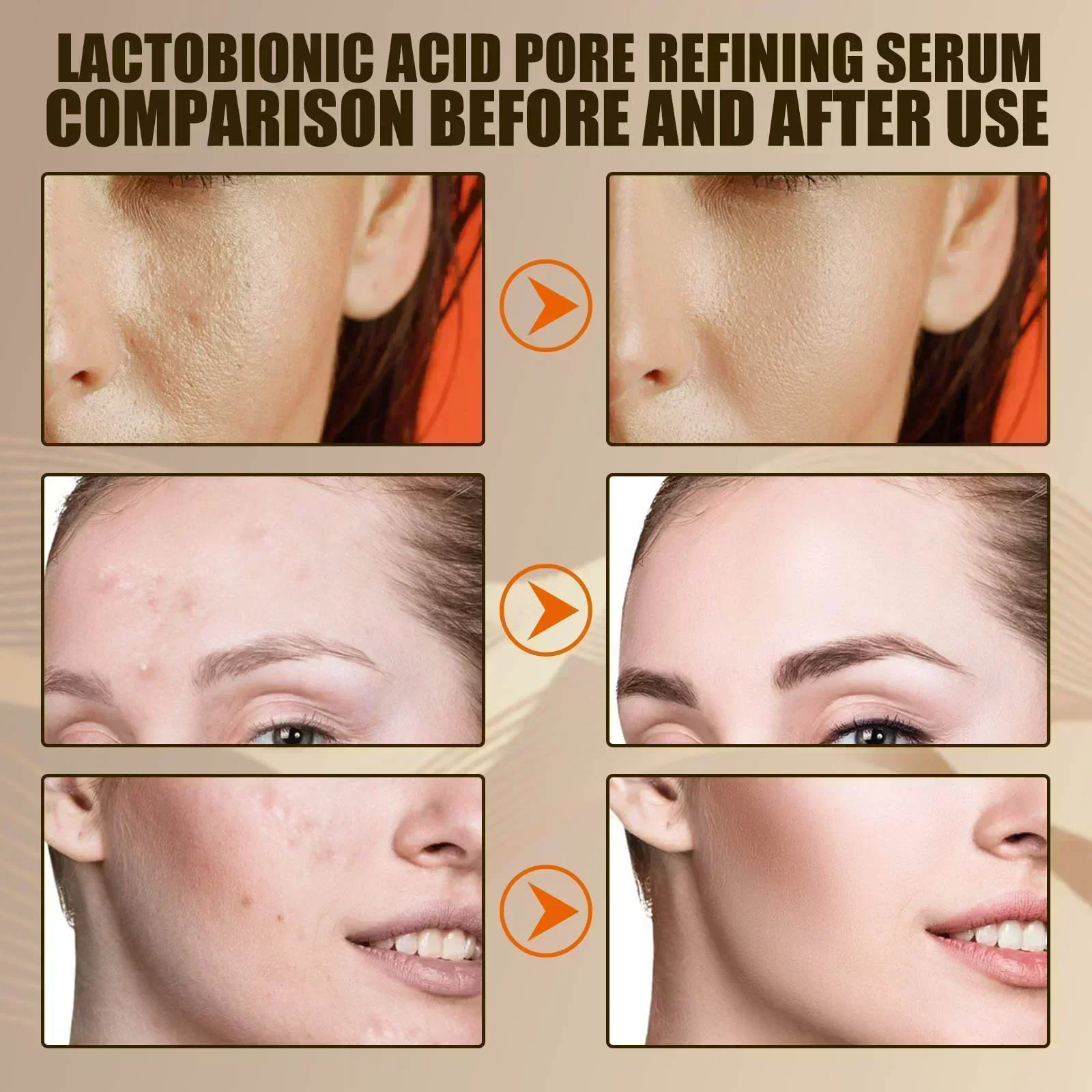 Poro encolher rosto soro remover cravos acne acidez controle de óleo reparação essência hidratante nutrir poros endurecimento cuidados faciais