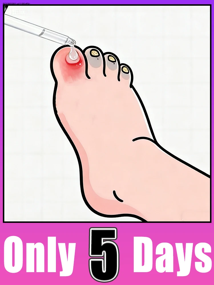 

Bʀᴇᴀᴋ ғʀᴇᴇ ғʀᴏᴍ ᴅʀʏ ᴄᴜᴛɪᴄʟᴇs, ғɪɴɢᴇʀᴛɪᴘs sᴛᴀʏ ᴍᴏɪsᴛ ᴀɴᴅ ɴᴏᴜʀɪsʜᴇᴅ