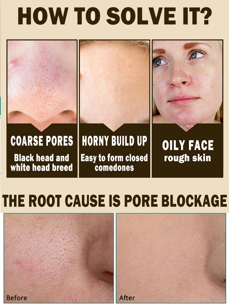 Effective Pores Remover Pore Shrinking Serum Shrink Tightening Minimizing  Serum Facial  Skin Care Products Acne Treatment