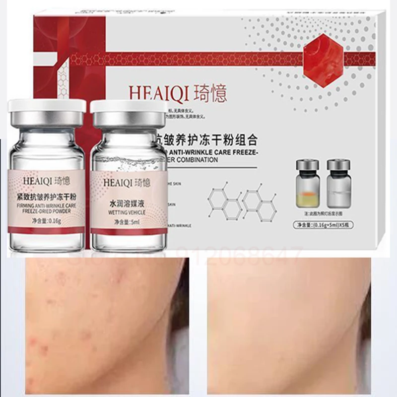 

l Type III Collagen Lyophilis Powder Kit Korean Cosmetics Active Repair FaciaHyaluronic Acid Moisturizing Rejuvenation Skincare
