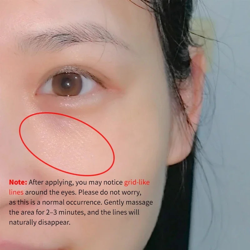 Collagen PDRN Pink Eye Patches Target Dark Circles Puffy Eyes Slip Resistant Under Eye Mask Rejuvenate Eye Area