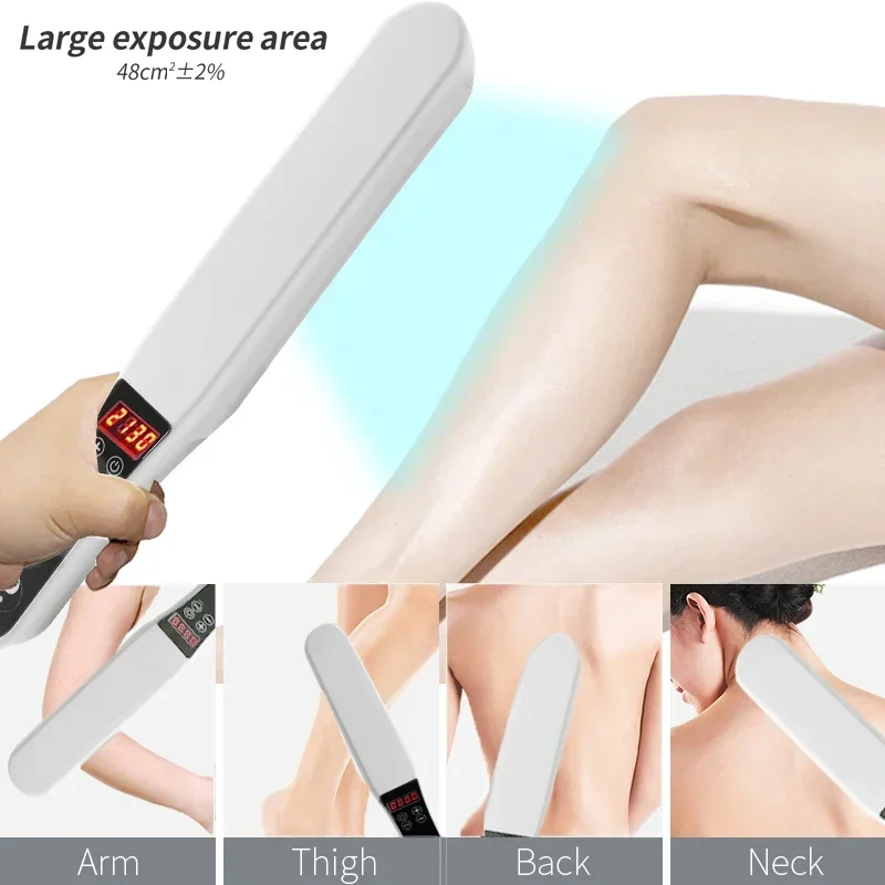 311nm Narrowband UVB Phototherapy Lamp 48cm² Large Coverage Handheld Digital Timer UV Light Home Auxiliary Skin Care for Vitilig - view 3