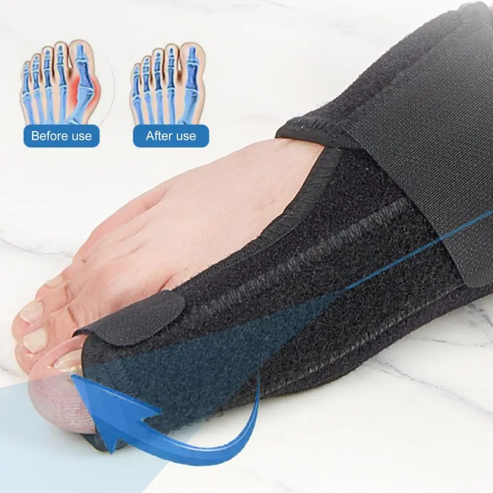 Breathable Bunion Support Bunion Corrector Splint Set for Pain Relief Hallux Valgus Correction Toe Separator for Men for Hammer