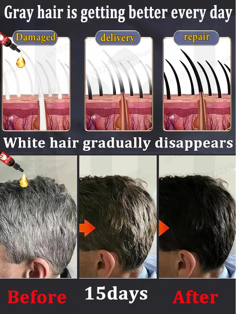 

ᶠᵘⁿᵍᵃˡ ᵗᵒᵉ ⁿᵃⁱˡ ᵗʳᵉᵃᵗᵐᵉⁿᵗ