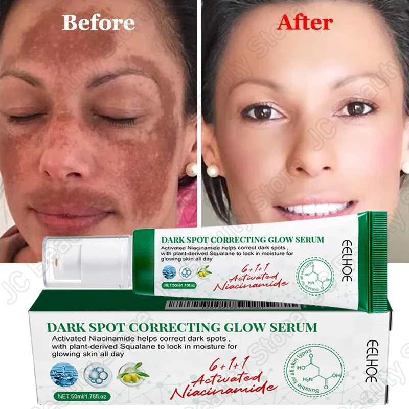 Dark Spots Remover Whitening Serum Face Freckle Melanin Correcting Anti Pigmentation Brighten Essence Cream Korean Skin Care