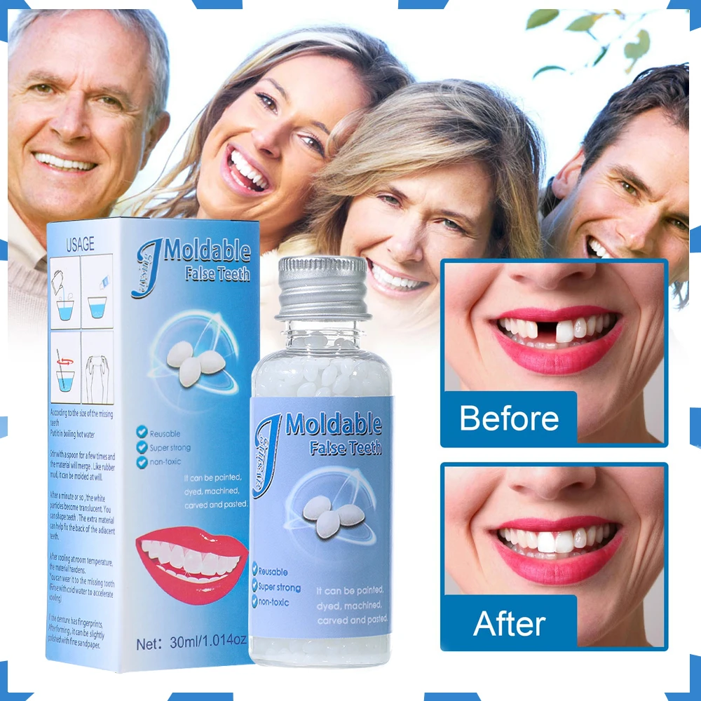 30ml Dental Resin Shapeable Teeth Glue Makeup Dentures Modification Temporary Filling Teeth Repair Broken Tooth Gaps Accessories