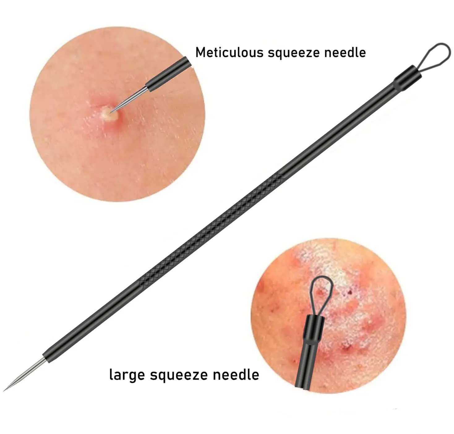 Ensemble d'aiguilles professionnelles pour points noirs du visage, extracteur de points blancs d'acné en acier inoxydable, outil de nettoyage en profondeur du visage, 4