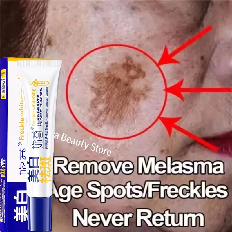 Potente crema blanqueadora eliminadora de manchas, ilumina la piel, elimina la pigmentación de melanina, Melasma, manchas oscuras, cuidado de la piel facial coreano