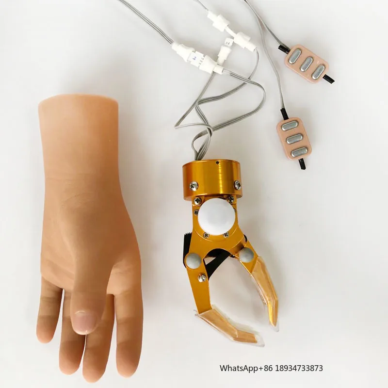 Artificial Limbs Upper Limb Hand Prosthesis Myoelectric Control Prosthetic Hand