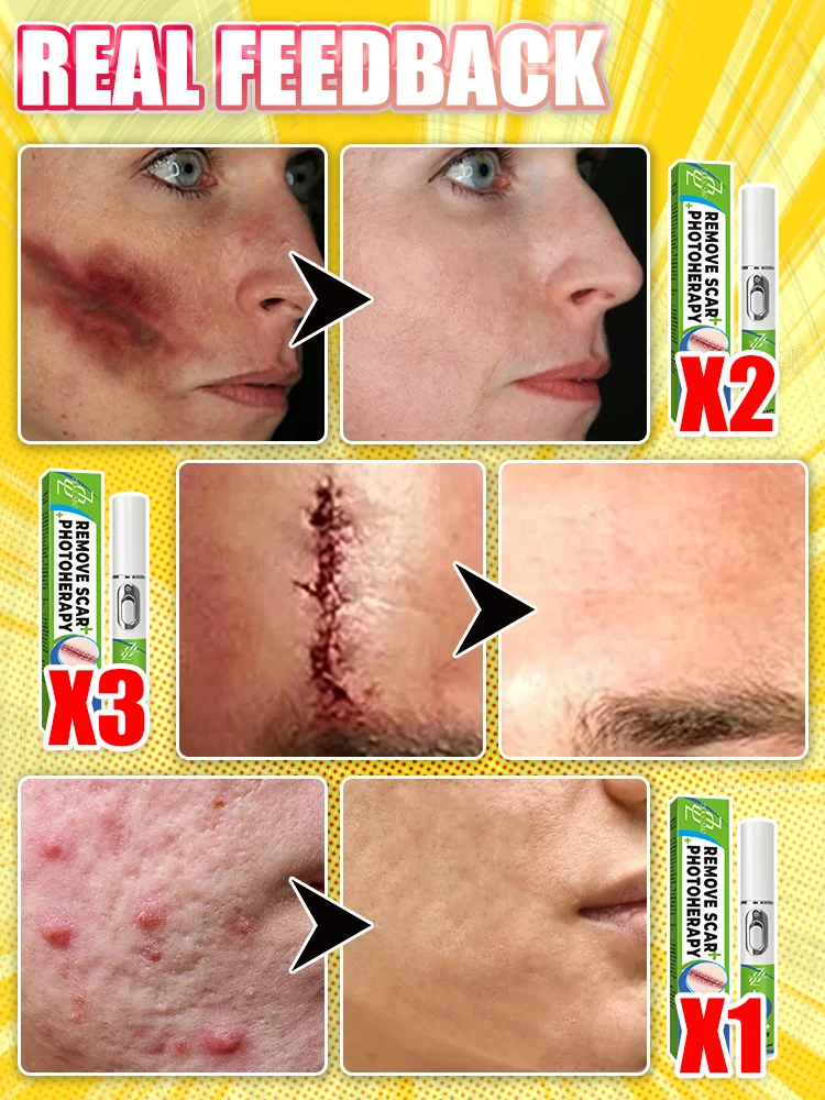 2025年最新レーザー療法による様々な外科的治療と臥床期の治療