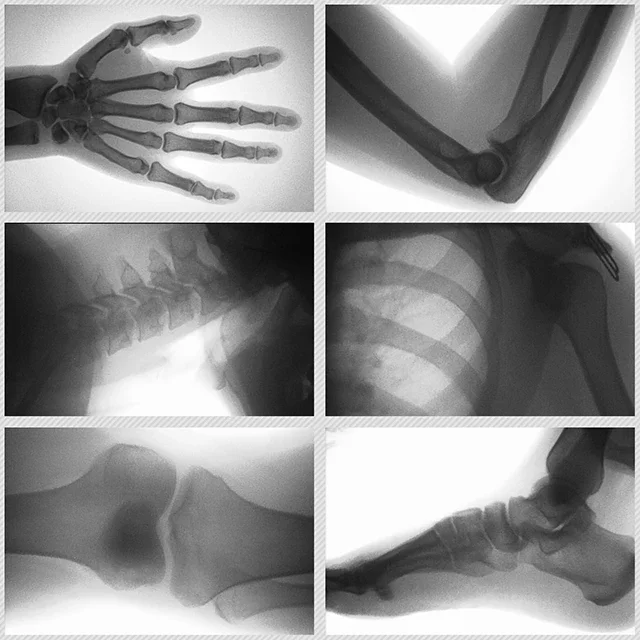 Máquina de rayos X humana veterinario Digital portátil de mano, veterinarios digitales de rayos x