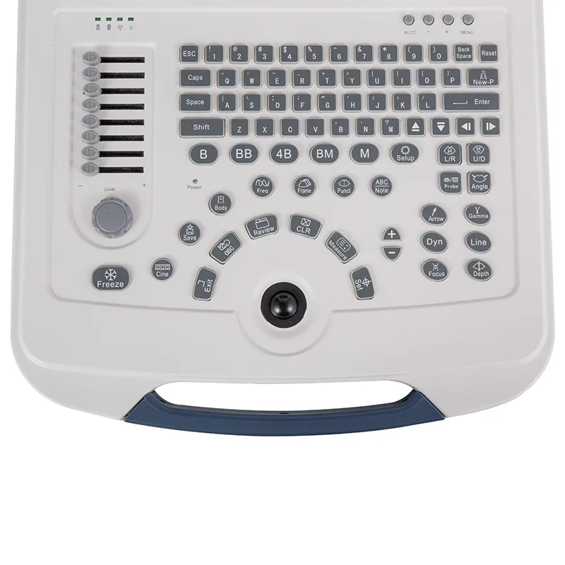 Medical Ultrasound Machine laptop portable ultrasound scanner machine YC-580 by Yicare