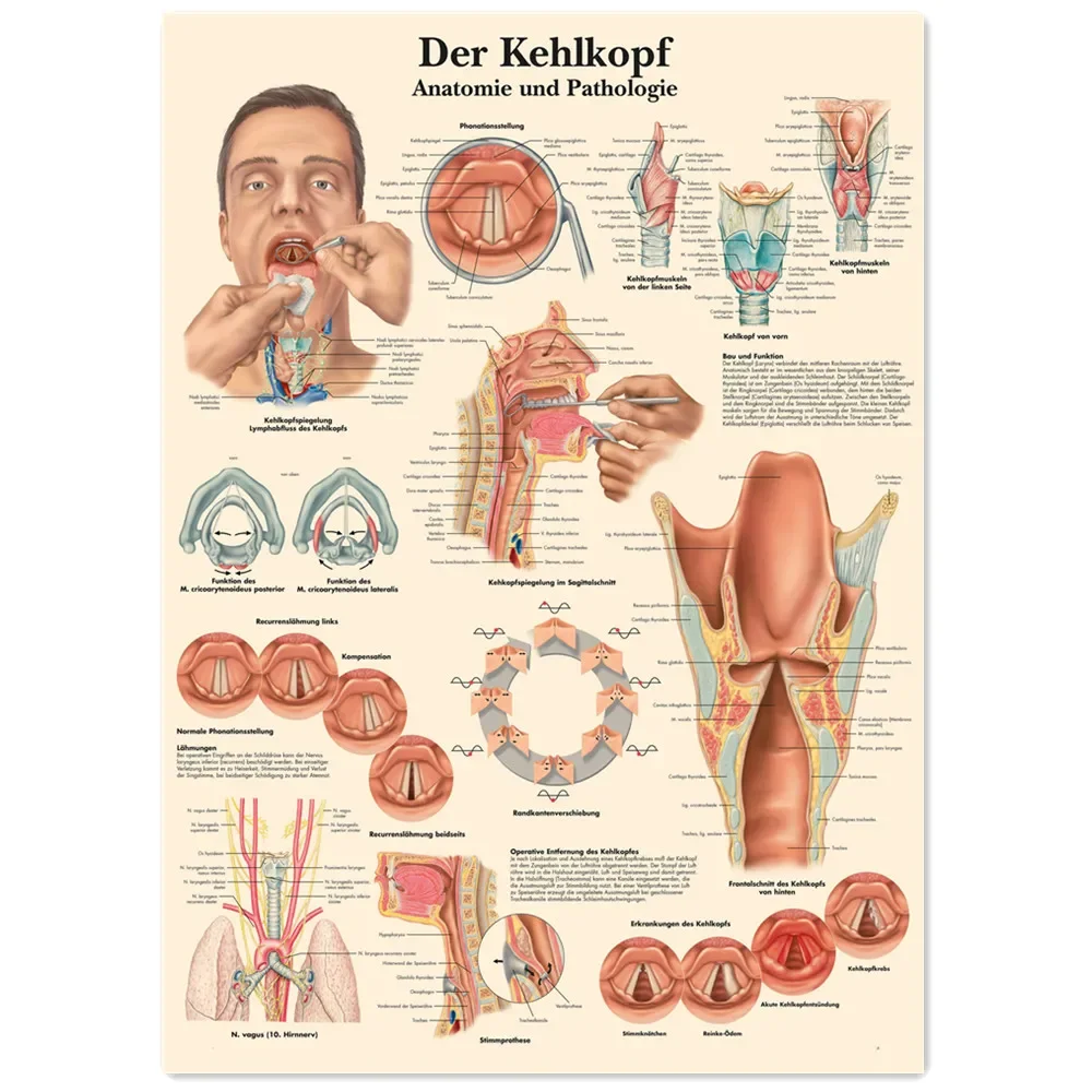 The Larynx Posters and Prints Human Anatomy Wall Art Vintage Kraft Paper Painting Wall Chart Hospital Clinic Home Decor Sticker