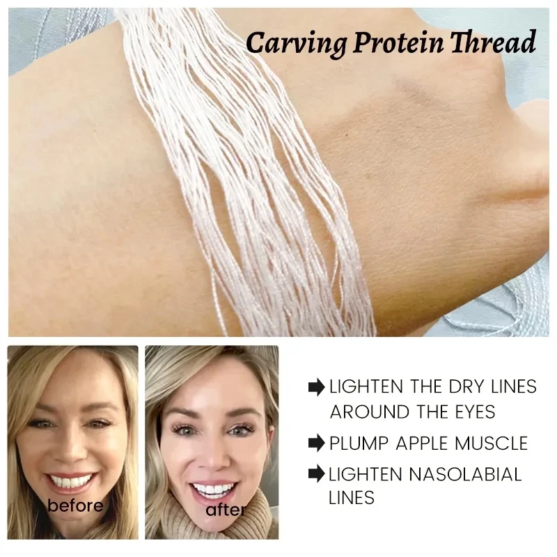 Protein Thread No Needle Gold Protein Line Absorbable Anti-wrinkle Face Filler Women Beauty Care Skin Collagen Based