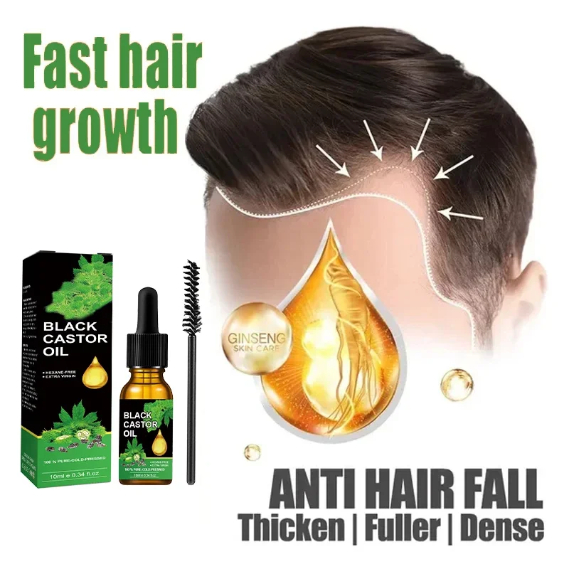 

Nurturing hair Reducing hair-loss and breakage Hairs Care Rosemary Essential Oils Anti Hair-Loss