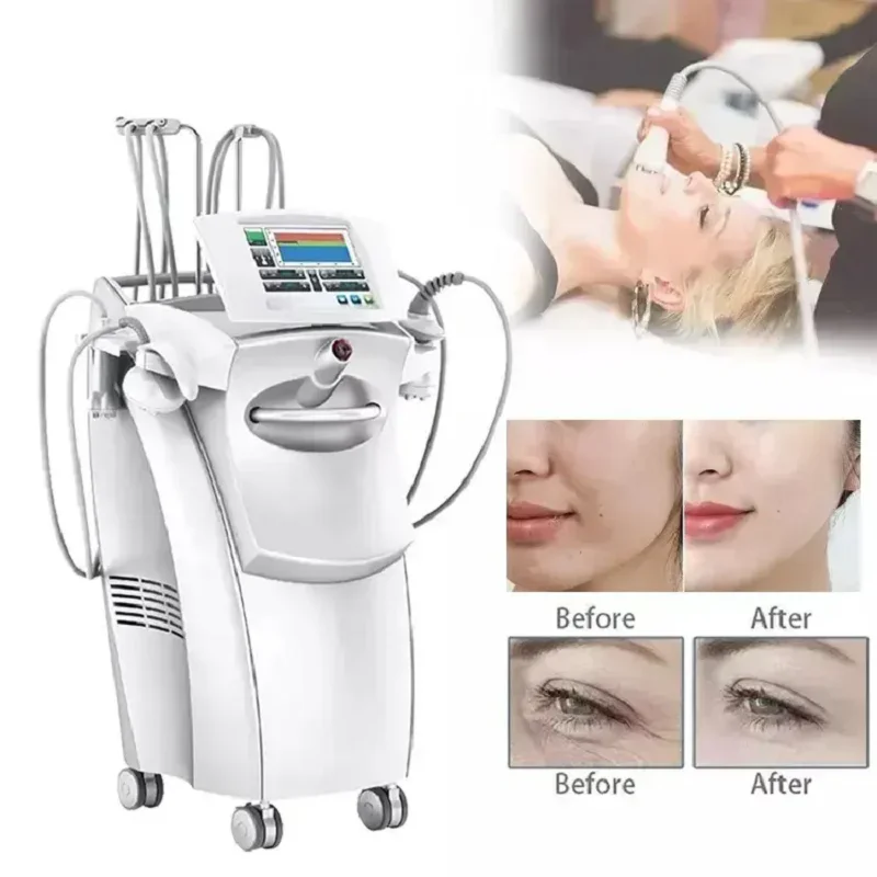 

Actimel Venus Legacy Equipment Skin Tightening Vacuum slimming Cellulite Removal Vacuum Legacy Skin Lifting SPA Device For Salon