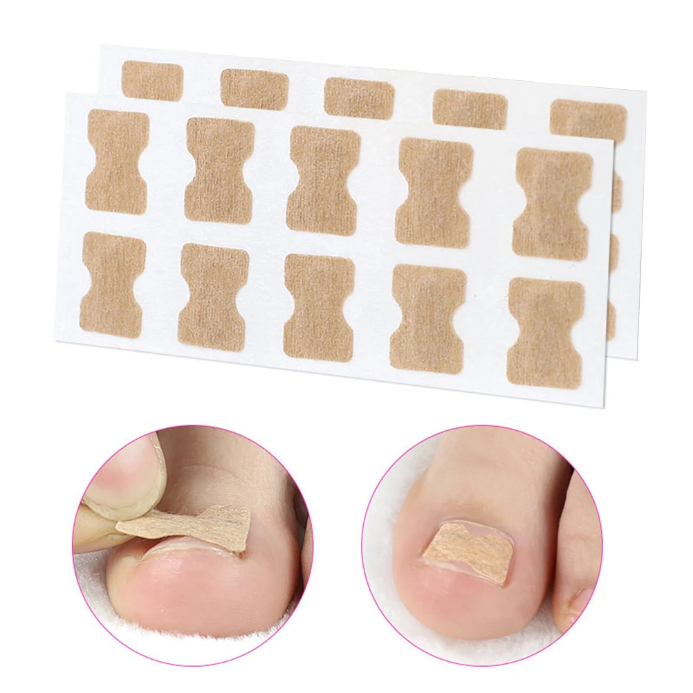 

2 Sheets Toenail Corrector Ingrown Nail Sticker Paronychia Relief Nail Groove Treatment Portable Foot Care Tool Sandal Friendly