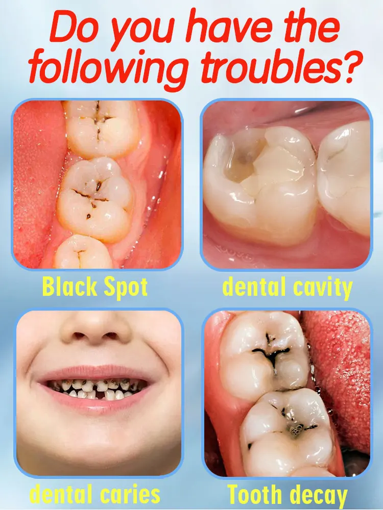 Solves caries and teeth decay problem