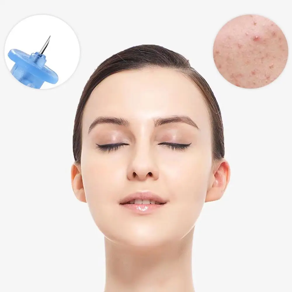 50Pcs/Box Blackhead Remover Disposable Acne Needle Professional Skin Care Blackhead Remover Tool Blemish Extractor Blue