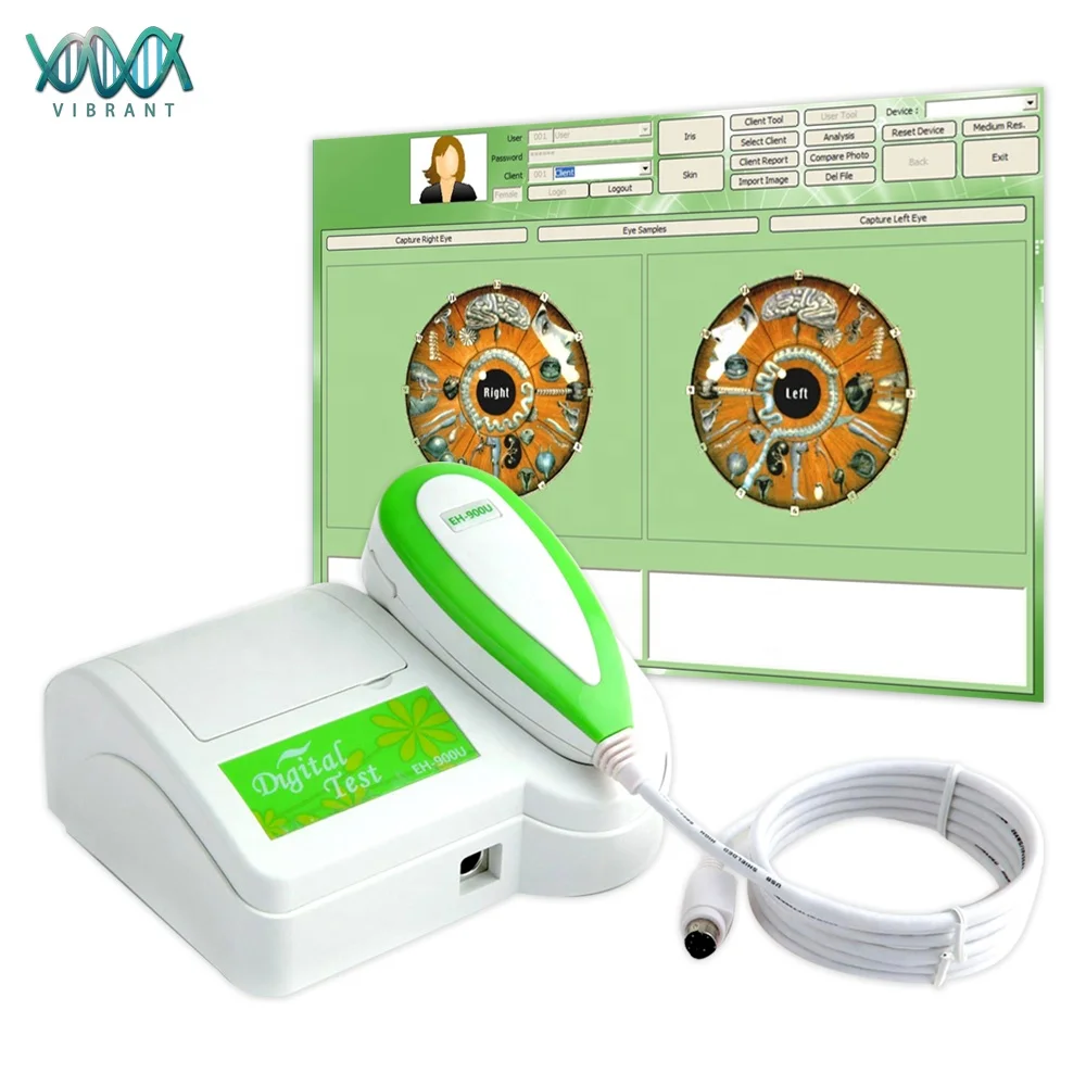 Hi-Accuracy portable 5.0 mp usb digital iriscope eye testing equipment