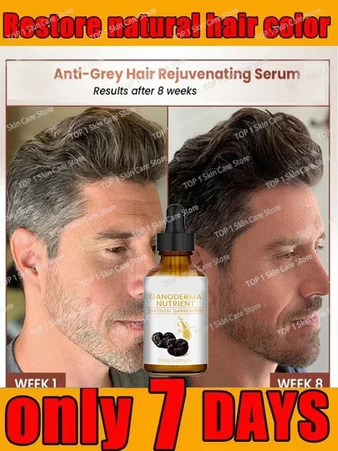 

White Hair Care - Grey hair Serum White hairs essence Anti-gray hair, regrow black hairSerum White hairs essence black hair