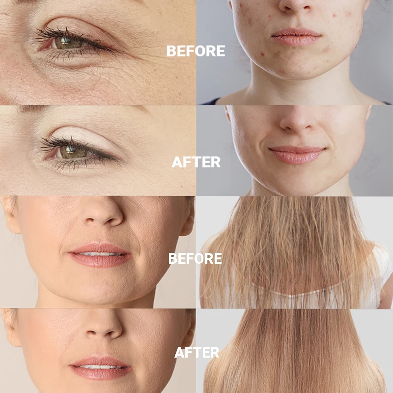 أقطاب كهربائية بديلة عالية التردد أنبوب زجاجي عصا العلاج الكهربائي للوجه العناية بالبشرة مزيل البقع جهاز التجميل عصا العلاج