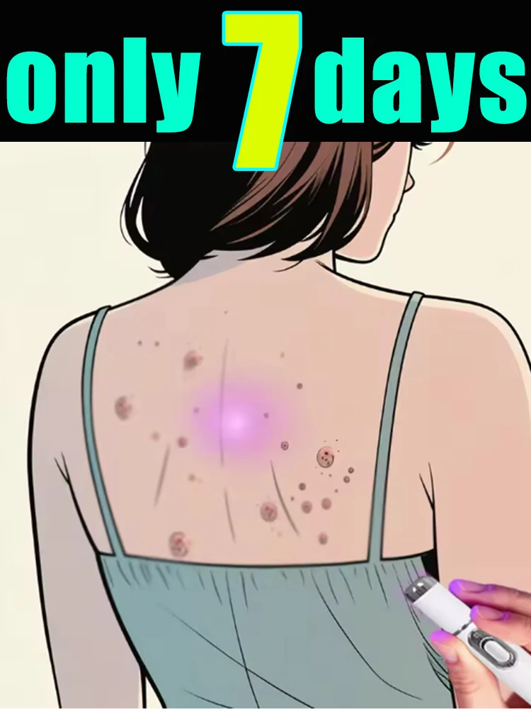 

Effectively removes warts without recurrence, gentle and non-irritating, super safe, and super convenient to use at home