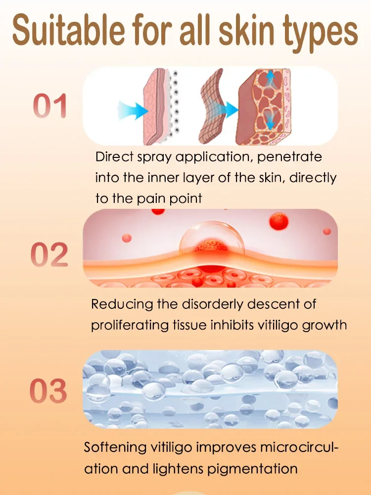 Pomada anti-vitiligo para cuidados com a pele, anti-vit, anti-vit, anti-vit