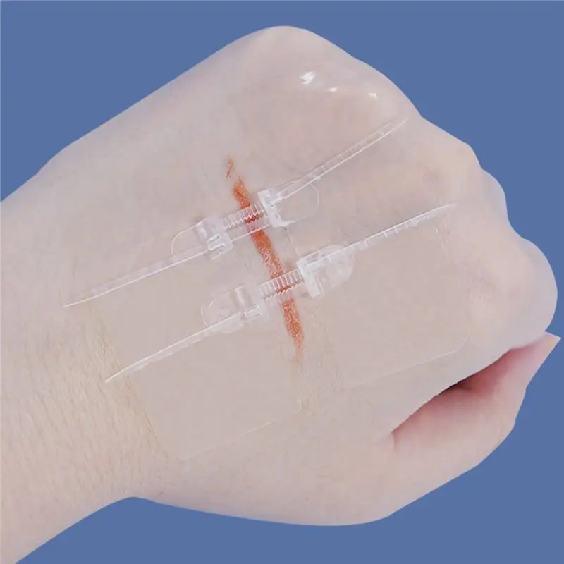 [NEW A09R!】 Quick Clot Zip Device Emergency Wound Closure Strips 4Pcs Butterfly Bandages