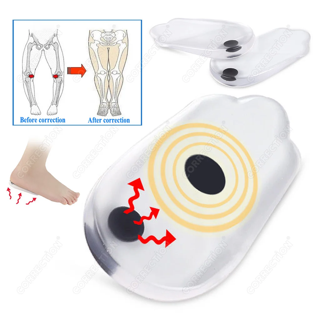 2/4 PCS Orthopedic Insoles for Feet O/X Leg Type Valgus Correction Men Women Silicone Gel Shoes Insole Magnet Massage Shoe Pads