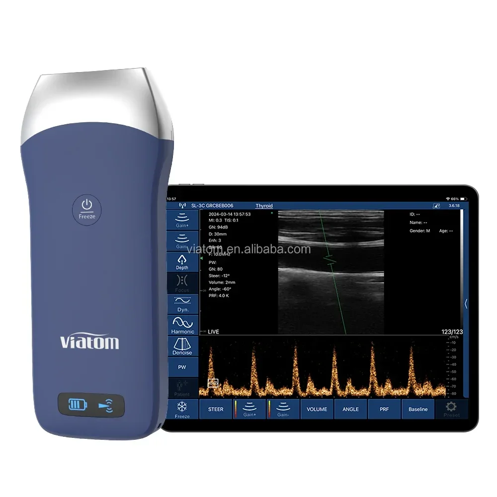 

Viatom 128 Elements Ultrasound Linear Probe 7.5/10mhz Wireless Ultrasound Handheld Ultrasound Scanner Working With Phone