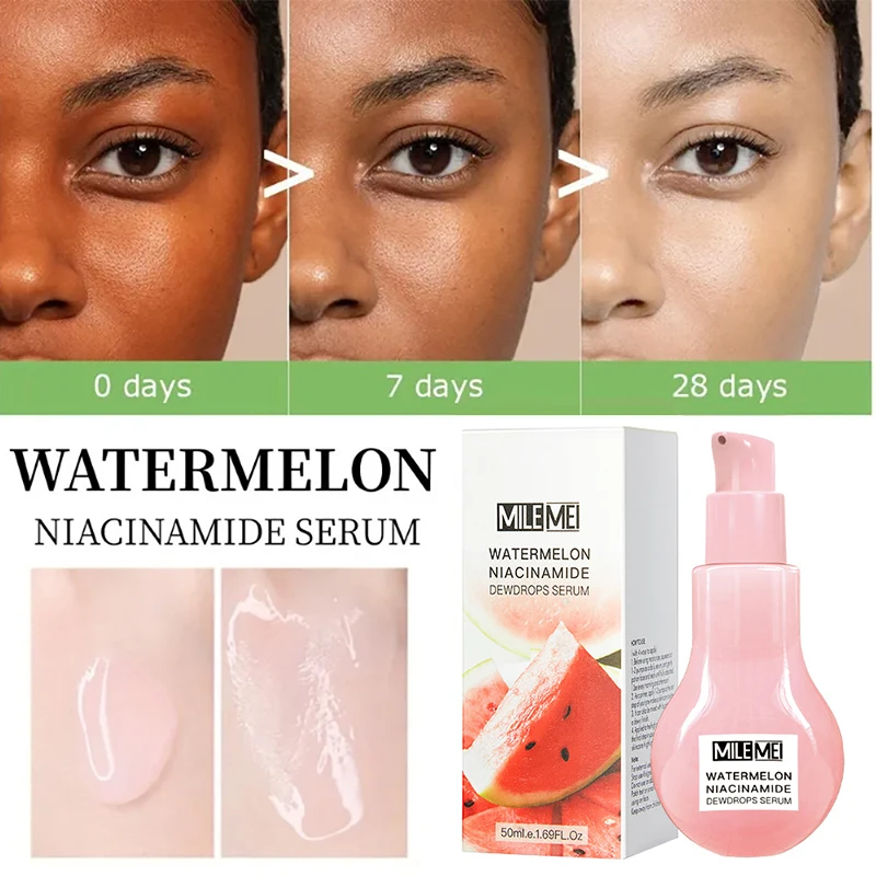 Watermelon Nicotinamide Bulb Essence Glow Recipe Cosmetics Moisturizing Lotion Essence Whitening And Brightening Skin Makeup