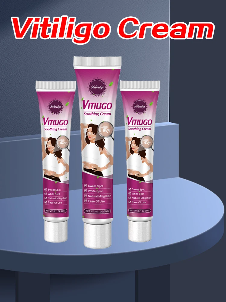 Vitiligo Cream