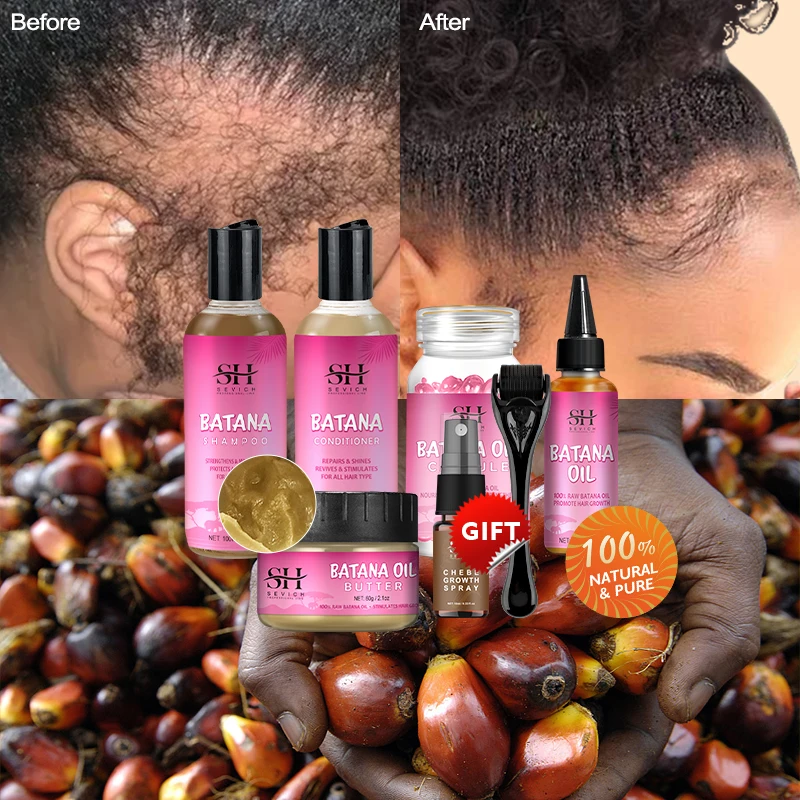 100% Pure Batana Hair Growth Oil Fast Hair Regrowth Serum Prevent Baldness Anti Hair Loss Scalp Treatment Men Women Hair care