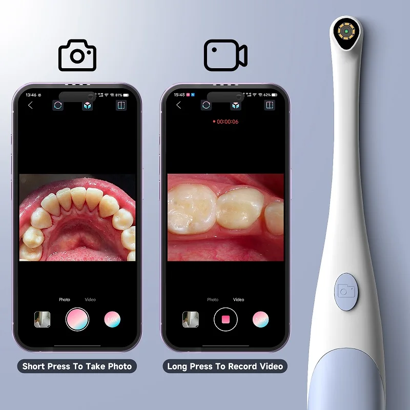 Oral Endoscope Camera 1440P Photo&Video Handheld Visual Borescope with 8 LED Lights Home Care System For Dental/Tooth Inspec view 3