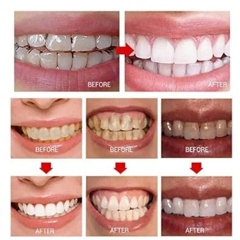 قلم تبييض الأسنان قلم تبييض الأسنان الأبيض المبهر قلم تبييض الأسنان الفوري أدوات العناية بصحة الأسنان #2