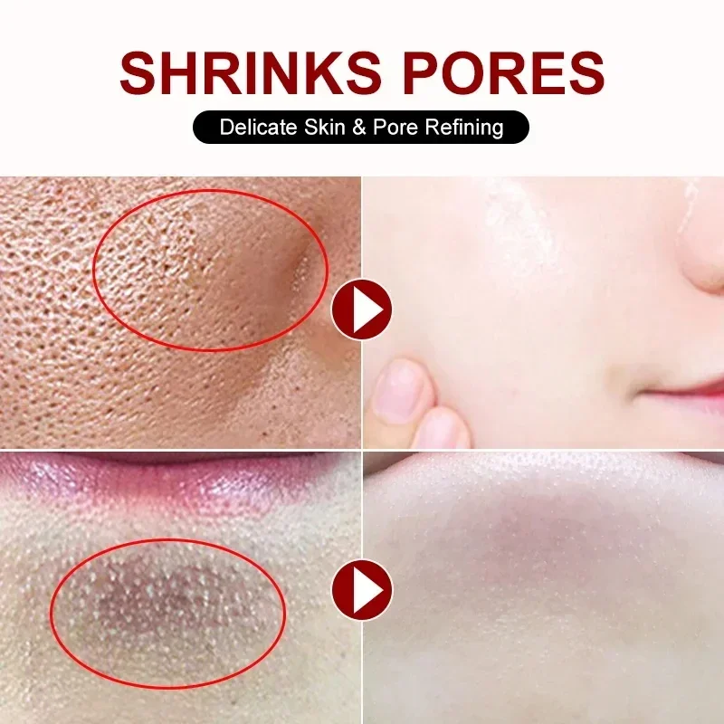 Crème de rétrécissement des pores à l'acide salicVAC, élimination rapide des grands pores, élimination des points noirs, resserrement du visage lisse, réparation, produits de soins pour la peau