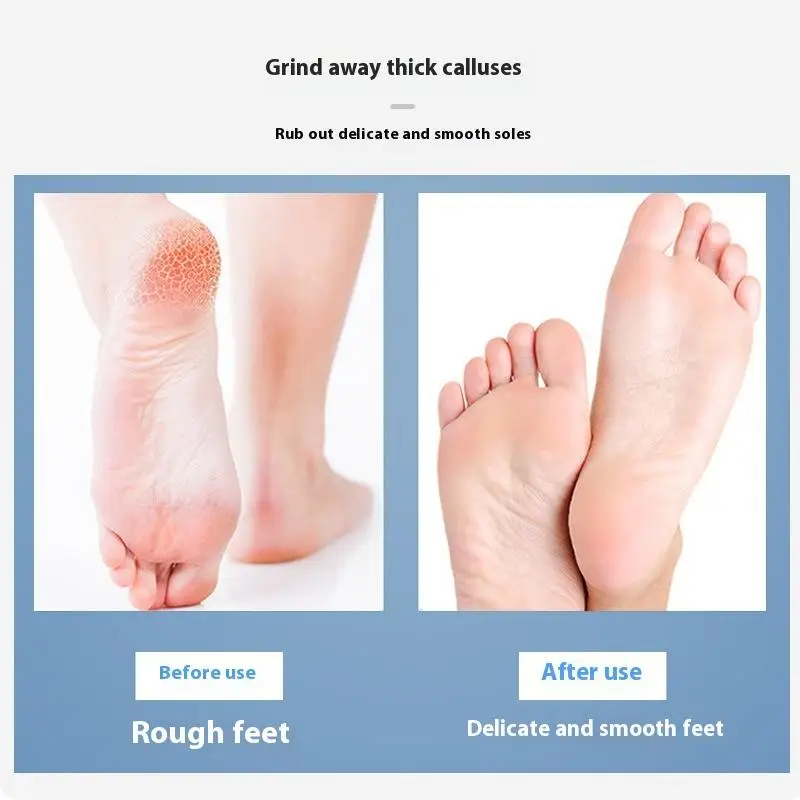 Składany dwustronny pilnik do stóp ze stali nierdzewnej do usuwania zrogowaceń, profesjonalne narzędzia do pedicure, skrobak do zrogowaceń.