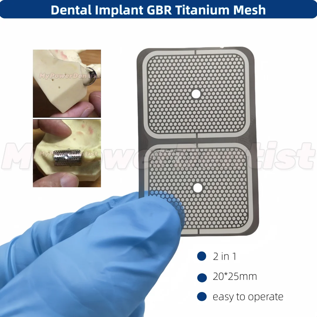 

10Pcs Dental GBR Titanium Mesh Bone Regeneration Titanium Film Oral Implant Mesh 2 in 1