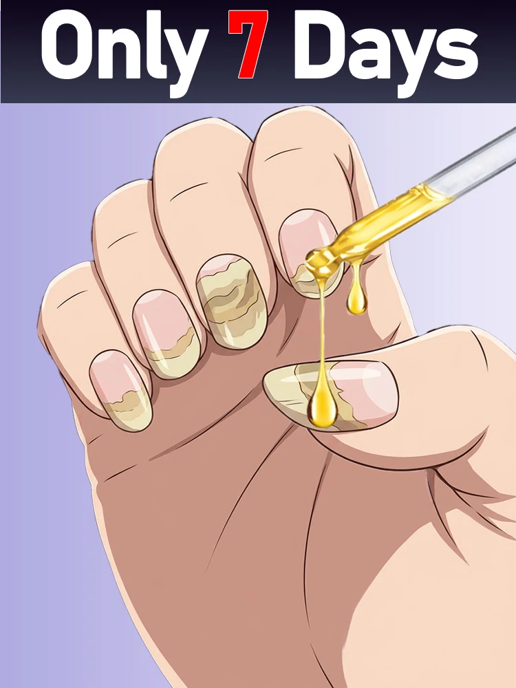 2026 New Product, Next-Generation Nail Polish, Completely Upgraded, Gentle and Safe