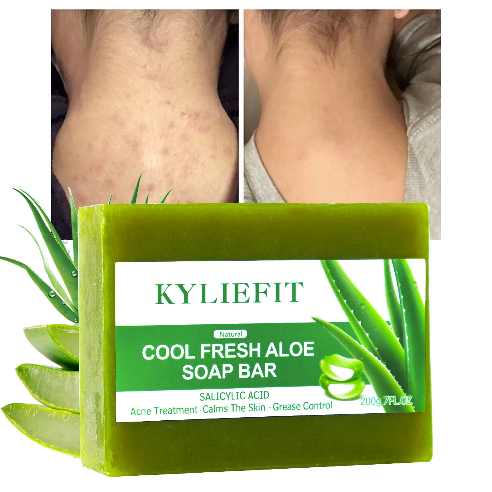 Aloe aufhellen der Seifens tück, reduzieren dunkle Flecken, Sonnen flecken, Akne, Öl kontrolle, saubere Flecken, Peeling, für Gesicht und Körper