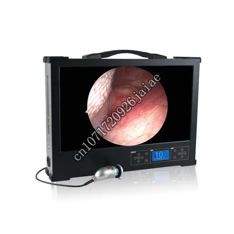 Portable Hd Endoscope Ccd  System Ent Digital Flexible Urology Ureteroscope Nephroscope   