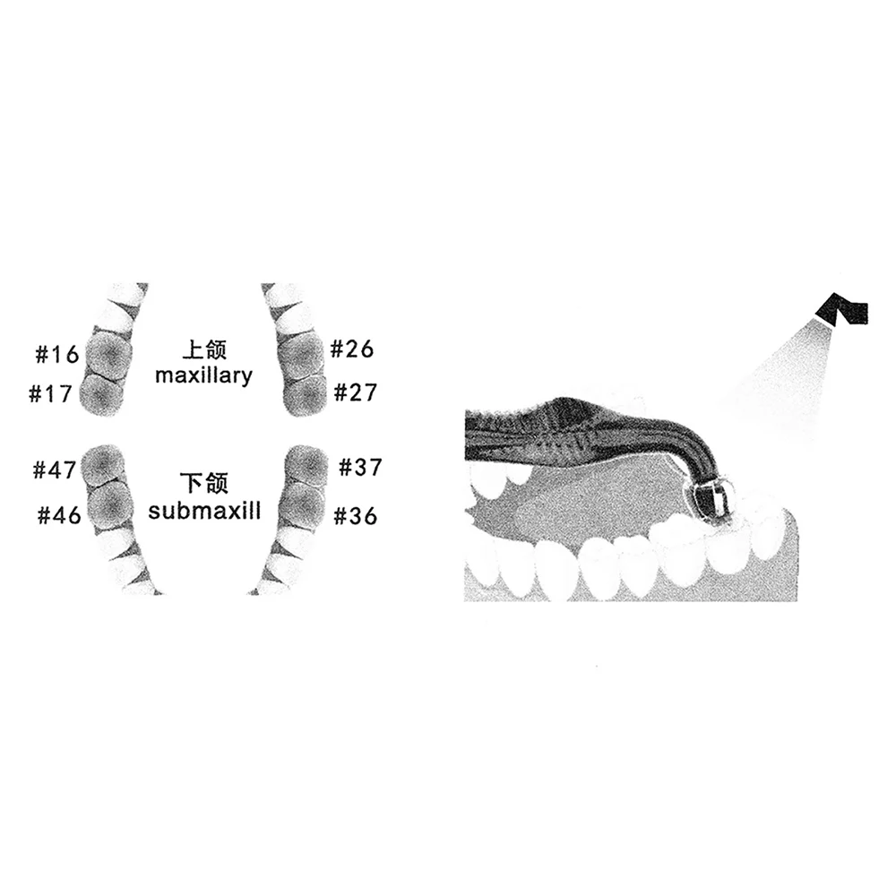 AZDENT-Conjunto De Acessórios Odontológicos, Dentes Posteriores Dentais, Kit De Impressão Estética, Restauração De Moldes, Ferramentas De Enchimento, 16 Dentes, Odontologia