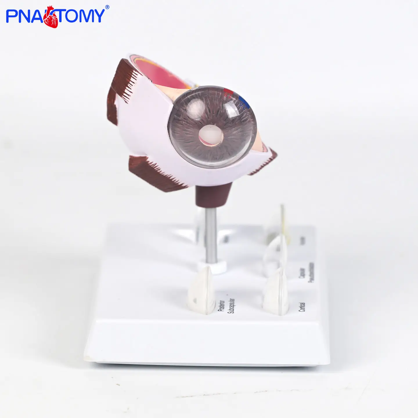 

Pathological Eyeball Model Eyeball Model Corneal Lesion Eyeball Model Medical Teaching Material Model
