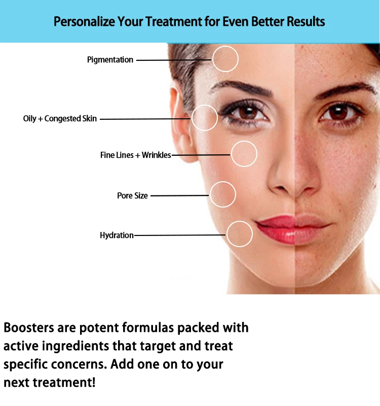 Original Sale H2O2 Deep Cleaning Aqua Peel Facial for Bio Micro Oxygenation Facial Face Lifting Diamond Dermo Brassion